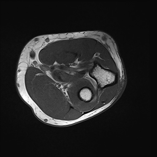 Click on the Serie image to view the images of Wieszt, Gnter